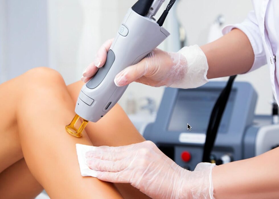 Αποτρίχωση Laser αλεξανδρίτη σε γυναίκες στο Περιστέρι Αττικής