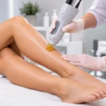 Πόσες Συνεδρίες Laser Χρειάζονται για Μόνιμα Αποτελέσματα;