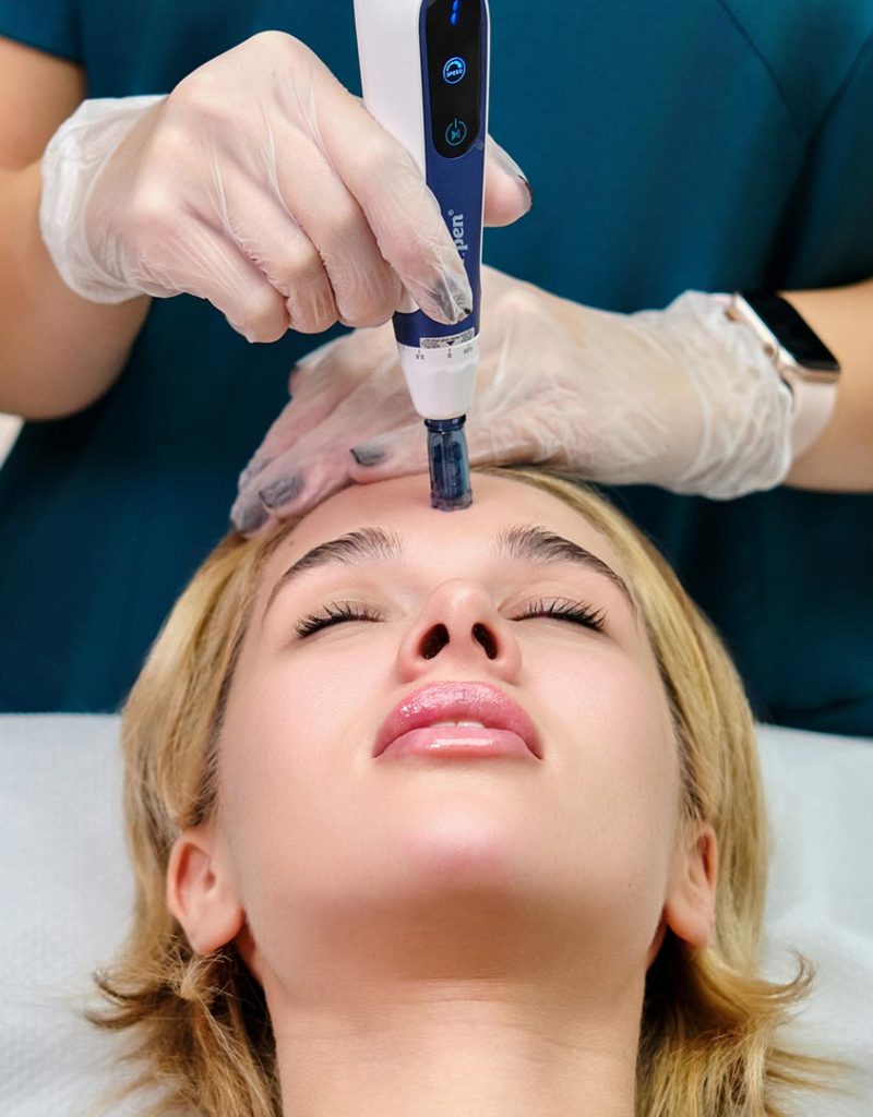 Μεσοθεραπεία Dermapen